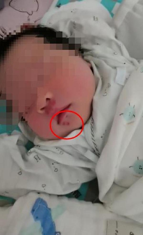 刚出生11天女儿半夜突然大哭浑身是血 刚出生就遭这样的罪